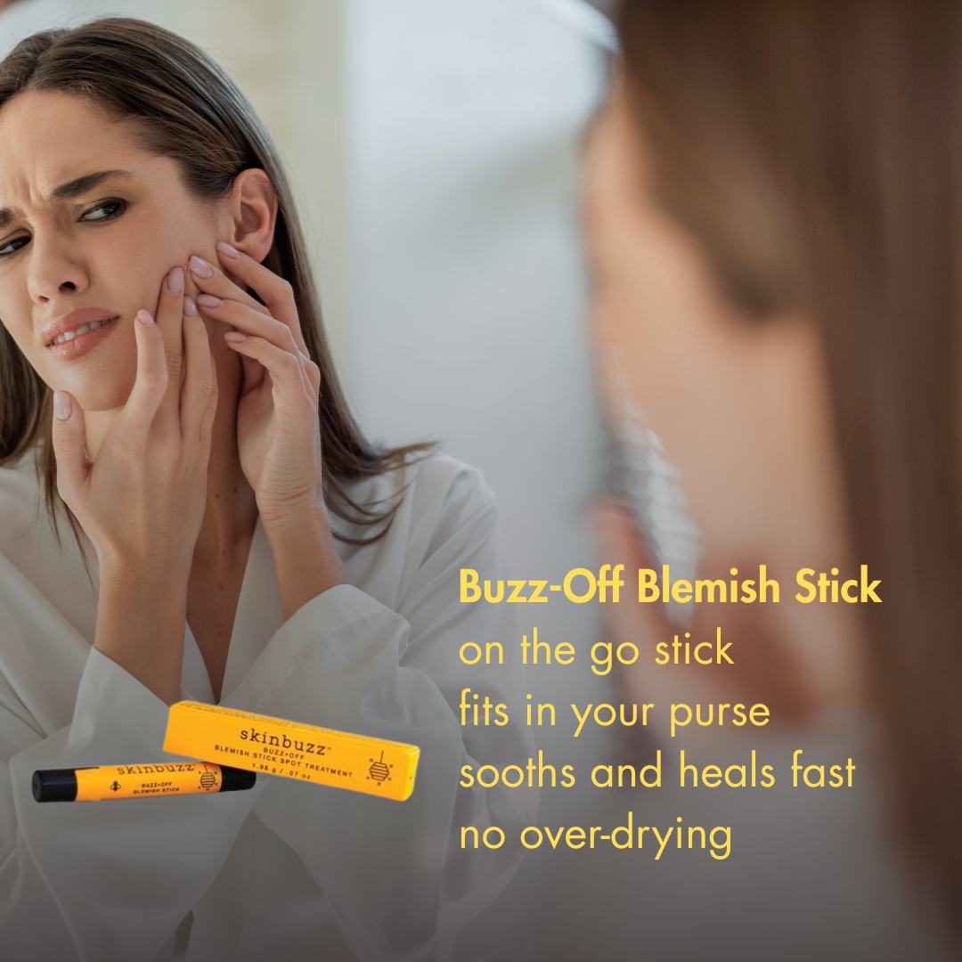Looking for a Gentler Alternative to Desert Essence Blemish Touch Stick?
