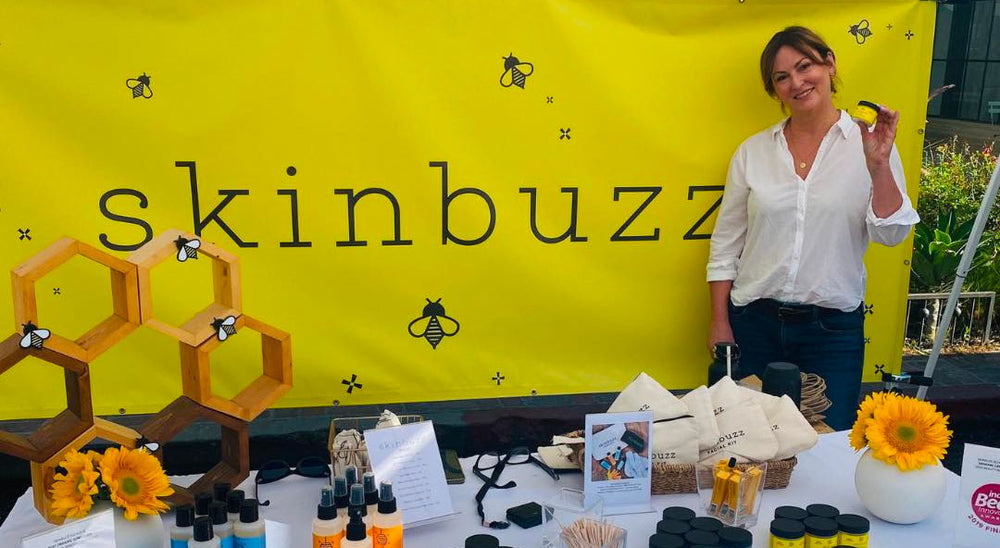 Skinbuzz